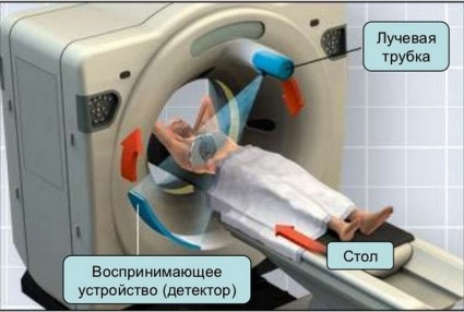 Сканирование шейного отдела позволяет оценить состояние исследуемой части позвоночного столба