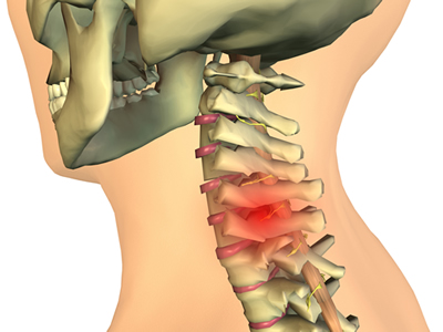 Внутри шейных позвонков проходят важные артерии и вены