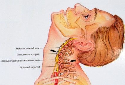 Анатомия шейных позвонков