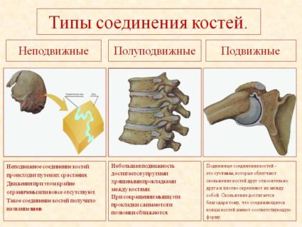 Изображение - Соединение костей неподвижные полуподвижные суставы 0017-017-Tipy-soedinenija-kostej-425x319