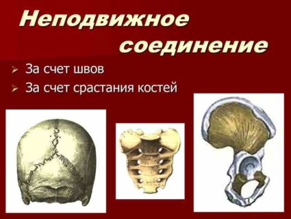 Соединение костей черепа