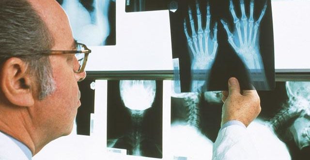 Рентгеновский снимок покажет степень поражения сустава
