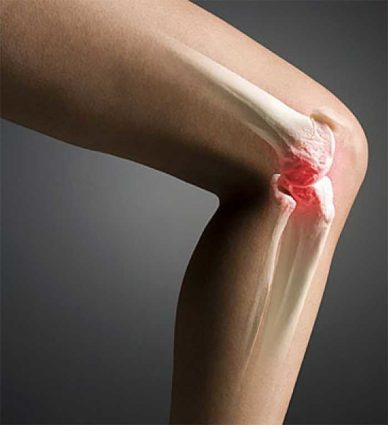 В основе большинства патологий суставов лежат чрезмерные нагрузки и их травмирование