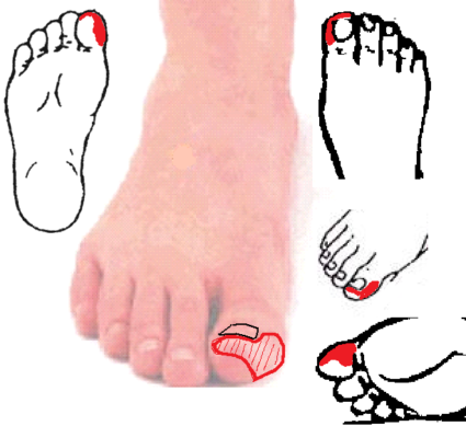 Необходимо выяснить причины, вызывающие онемение пальцев ног