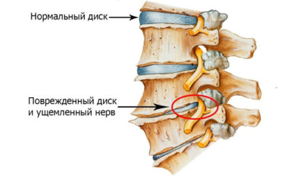 Тупая боль в спине – это признак проблем с позвоночником