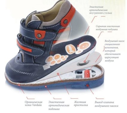 Детская ортопедическая обувь:правила выбора