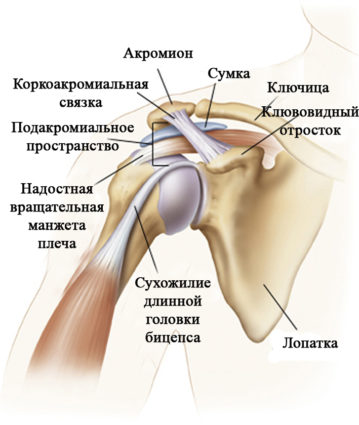Импиджмент-синдром связан с частыми перегрузками и воспалениями в плече