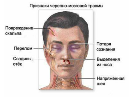 Симптомы травм черепа