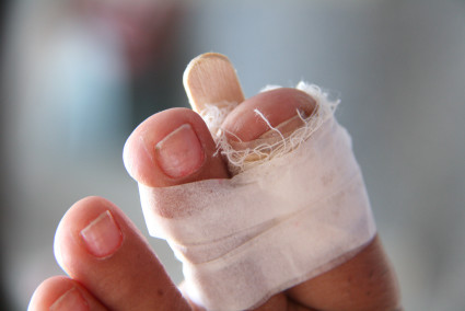 В медицине используется несколько методик лечения после забоя пальцев ног
