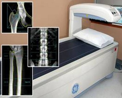 Ультразвуковая денситометрия,в основном, применяется для первичного обследования на остеопороз