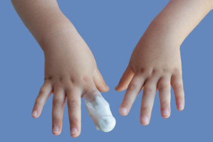 Травмирование пальцев на руке у детей случается не так часто, но приносит немало неудобств